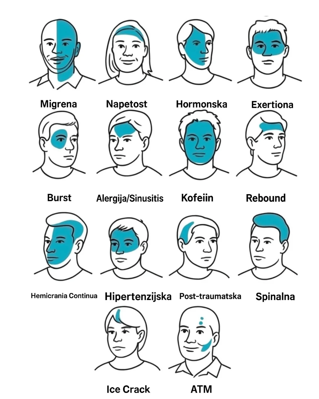 🧠 Dodatni savjet: Obratite pažnju na mjesto bola i prateće simptome. To može pomoći u određivanju najboljeg načina ublažavanja. Ako niste sigurni, obratite se zdravstvenom stručnjaku za savjet.