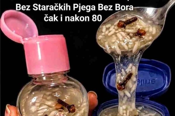 Proizvodnja kolagena prirodno opada nakon srednjih dvadesetih godina, što dovodi do pojave finih linija, opuštenosti kože i suhoće. Iako komercijalne kreme mogu pomoći, jednako učinkovitu formulu možete napraviti i kod kuće koristeći tri jednostavna sastojka: karanfilić, baby ulje i rižu. Karanfilić sadrži snažan antioksidans eugenol koji se bori protiv oštećenja uzrokovanih slobodnim radikalima. Riža je bogata aminokiselinama i peptidima koji posvjetljuju ten i jačaju zaštitnu barijeru kože. Baby ulje zadržava vlagu, omogućavajući aktivnim sastojcima da djeluju duže i dublje. Dodavanjem aloe vere, vitamina E, meda, ružine vodice, bademovog ulja i malo kurkume, dobijate bogatu kremu koja pruža hidrataciju, sjaj i regeneraciju tokom noći — bez velikih troškova. Potrebni sastojci (Količina: oko 50 g) 2 kašičice cijelih karanfilića (lagano zdrobljenih) 3 kašike baby ulja bez mirisa 1 kašika fino mljevene riže 1 kašika svježeg aloe vera gela 1 kapsula vitamina E (≈ 400 IU) 1 kašičica sirovog meda 1 kašičica hladno cijeđenog bademovog ulja 1 kašičica ružine vodice ¼ kašičice kurkume (po želji) Postupak pripreme 1. Infuzija ulja Zagrijte baby ulje na vrlo laganoj temperaturi (oko 50°C). Dodajte zdrobljene karanfiliće i ostavite 20 minuta. Procijedite i ostavite da se malo ohladi. 2. Priprema riže Pomiješajte rižin prah sa 1 kašikom tople destilirane vode dok ne dobijete glatku smjesu. 3. Spajanje sastojaka Polako dodajte toplo ulje u smjesu riže uz stalno miješanje. Miješajte dok ne dobijete gustu, kremastu teksturu. 4. Dodavanje aktivnih sastojaka Kada se smjesa ohladi (ispod 40°C), dodajte aloe veru, med, vitamin E, bademovo ulje, ružinu vodu i kurkumu. Dobro promiješajte dok smjesa ne postane ujednačena. 5. Čuvanje Prebacite kremu u čistu staklenu posudu (oko 50 g). Označite datum i čuvajte u frižideru do 2 mjeseca. Kako koristiti Test osjetljivosti: Nanesite malu količinu na unutrašnju stranu lakta i sačekajte 24 sata. Noćna primjena: Nakon čišćenja lica, nanesite malu količinu na lice i vrat (izbjegavajte područje oko očiju). Masaža: Lagano masirajte uzlaznim pokretima oko 60 sekundi. Učestalost: Počnite 3 puta sedmično, zatim koristite svaku noć ako koža dobro reaguje. Higijena: Uvijek koristite čiste ruke ili špatulu. Prednosti ove prirodne kreme Smanjuje bore i fine linije zahvaljujući snažnim antioksidansima Posvjetljuje i ujednačava ten Dubinski hidrira i daje zdrav sjaj kože Jača zaštitnu barijeru kože Umiruje iritacije i crvenilo Ostavlja kožu mekanom, glatkom i blistavom