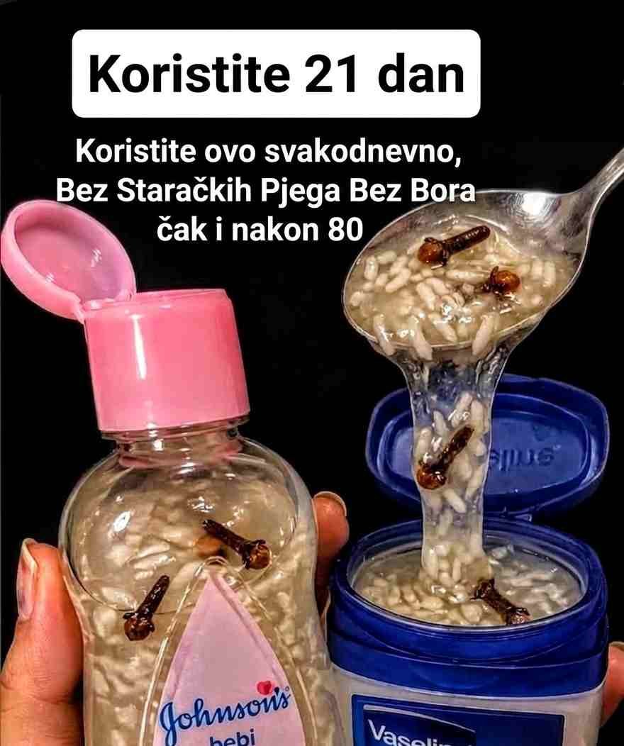 Proizvodnja kolagena prirodno opada nakon srednjih dvadesetih godina, što dovodi do pojave finih linija, opuštenosti kože i suhoće. Iako komercijalne kreme mogu pomoći, jednako učinkovitu formulu možete napraviti i kod kuće koristeći tri jednostavna sastojka: karanfilić, baby ulje i rižu. Karanfilić sadrži snažan antioksidans eugenol koji se bori protiv oštećenja uzrokovanih slobodnim radikalima. Riža je bogata aminokiselinama i peptidima koji posvjetljuju ten i jačaju zaštitnu barijeru kože. Baby ulje zadržava vlagu, omogućavajući aktivnim sastojcima da djeluju duže i dublje. Dodavanjem aloe vere, vitamina E, meda, ružine vodice, bademovog ulja i malo kurkume, dobijate bogatu kremu koja pruža hidrataciju, sjaj i regeneraciju tokom noći — bez velikih troškova. Potrebni sastojci (Količina: oko 50 g) 2 kašičice cijelih karanfilića (lagano zdrobljenih) 3 kašike baby ulja bez mirisa 1 kašika fino mljevene riže 1 kašika svježeg aloe vera gela 1 kapsula vitamina E (≈ 400 IU) 1 kašičica sirovog meda 1 kašičica hladno cijeđenog bademovog ulja 1 kašičica ružine vodice ¼ kašičice kurkume (po želji) Postupak pripreme 1. Infuzija ulja Zagrijte baby ulje na vrlo laganoj temperaturi (oko 50°C). Dodajte zdrobljene karanfiliće i ostavite 20 minuta. Procijedite i ostavite da se malo ohladi. 2. Priprema riže Pomiješajte rižin prah sa 1 kašikom tople destilirane vode dok ne dobijete glatku smjesu. 3. Spajanje sastojaka Polako dodajte toplo ulje u smjesu riže uz stalno miješanje. Miješajte dok ne dobijete gustu, kremastu teksturu. 4. Dodavanje aktivnih sastojaka Kada se smjesa ohladi (ispod 40°C), dodajte aloe veru, med, vitamin E, bademovo ulje, ružinu vodu i kurkumu. Dobro promiješajte dok smjesa ne postane ujednačena. 5. Čuvanje Prebacite kremu u čistu staklenu posudu (oko 50 g). Označite datum i čuvajte u frižideru do 2 mjeseca. Kako koristiti Test osjetljivosti: Nanesite malu količinu na unutrašnju stranu lakta i sačekajte 24 sata. Noćna primjena: Nakon čišćenja lica, nanesite malu količinu na lice i vrat (izbjegavajte područje oko očiju). Masaža: Lagano masirajte uzlaznim pokretima oko 60 sekundi. Učestalost: Počnite 3 puta sedmično, zatim koristite svaku noć ako koža dobro reaguje. Higijena: Uvijek koristite čiste ruke ili špatulu. Prednosti ove prirodne kreme Smanjuje bore i fine linije zahvaljujući snažnim antioksidansima Posvjetljuje i ujednačava ten Dubinski hidrira i daje zdrav sjaj kože Jača zaštitnu barijeru kože Umiruje iritacije i crvenilo Ostavlja kožu mekanom, glatkom i blistavom